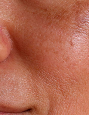 Marcos Alves Dermatologia as Melhores Tecnologias para Pele, Estética e Cabelo - Home Geral - Marcos Alves - Transplante Capilar e Dermatologia em BH